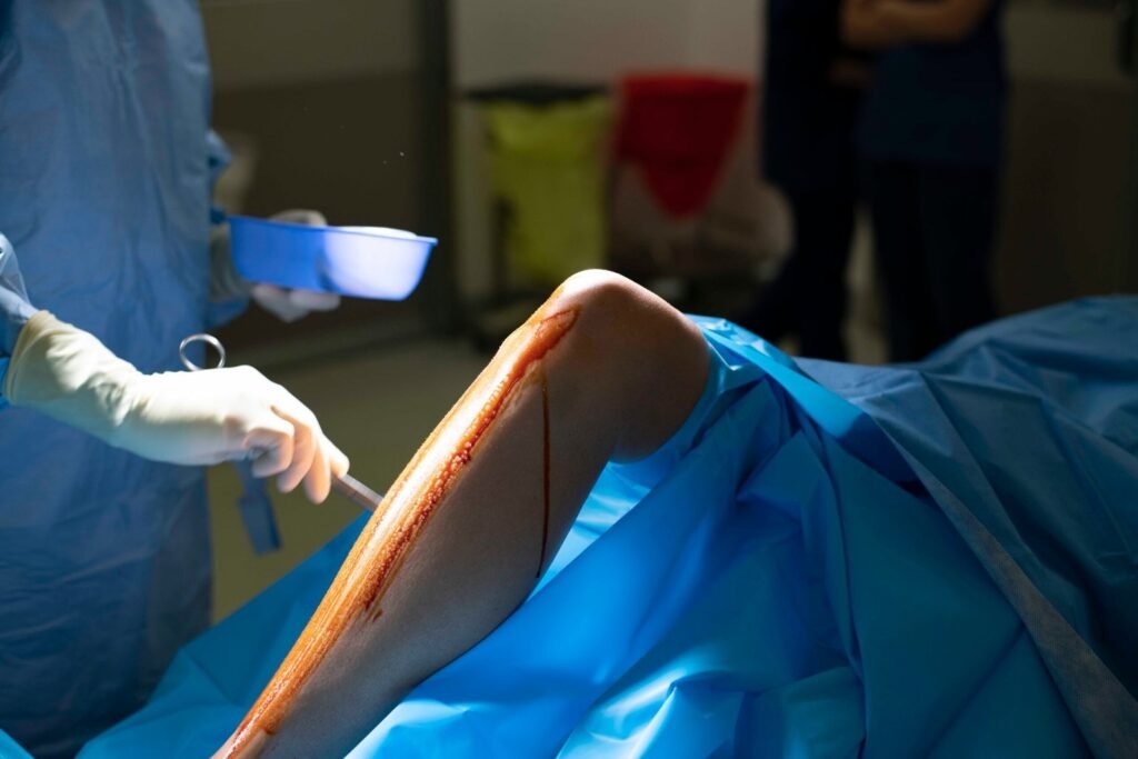 surgery scaled 1.jpg